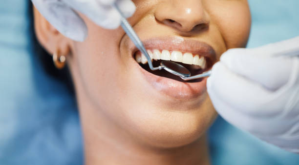 Best Broken or Cracked Tooth Emergency Dentist in Seville, OH