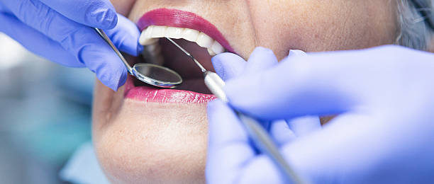 Best Emergency Dentist for Lost Fillings or Crowns in Seville, OH